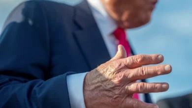 Photo of Больные вены и простой синяк? Врач Воробьев поставил Трампу другой диагноз