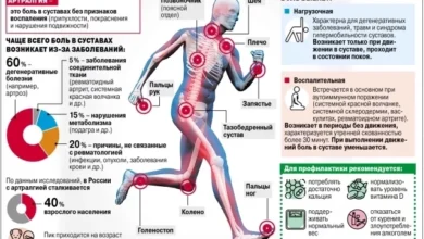 Photo of Как погода влияет на суставы и что делать, чтобы они не болели. Инфографика
