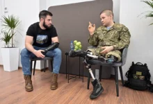 Photo of Обмани! Алголог Исагулян рассказал, как лечат фантомные боли после ампутации