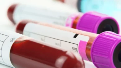 Photo of Как проверить, болел ли человек ветрянкой?