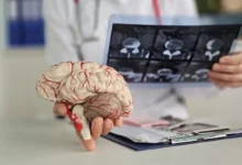 Photo of Скабрезная фарма. Найдено пикантное средство от болезни Альцгеймера