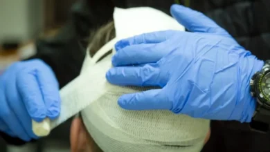 Photo of Это надо лечить. Даже легкая травма головы повышает риск Альцгеймера