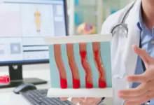 Photo of Слабые сосуды. Стало известно, передаются ли болезни сердца по наследству